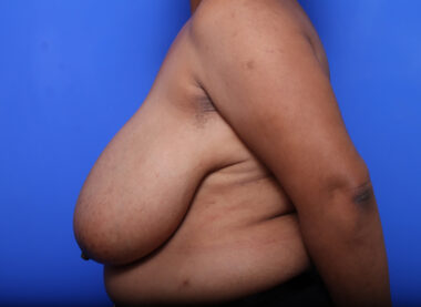 Case # 25 before photo