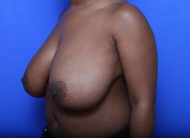 Case # 30 before photo