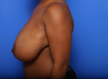 Case # 30 before photo