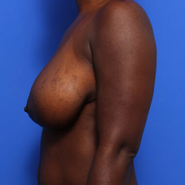 Case # 20 before photo