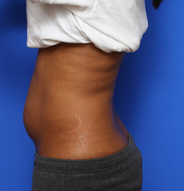 Case # 1 before photo