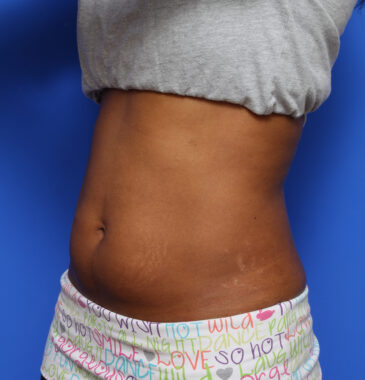 Case # 1 after photo