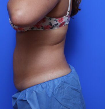 Case # 13 before photo