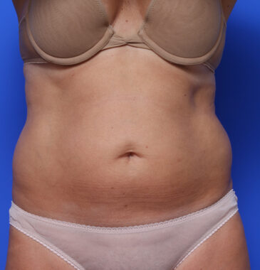 Case # 4 before photo