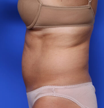 Case # 4 before photo