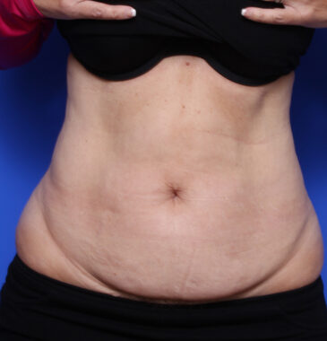 Case # 9 before photo