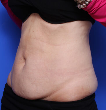 Case # 9 before photo