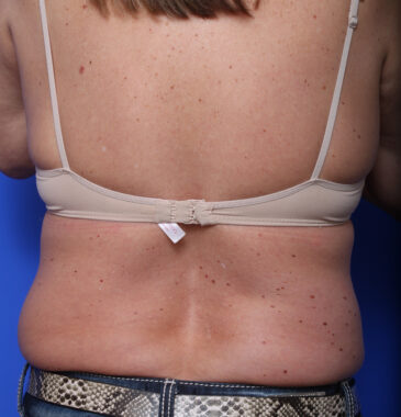 Case # 7 before photo