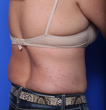 Case # 7 before photo