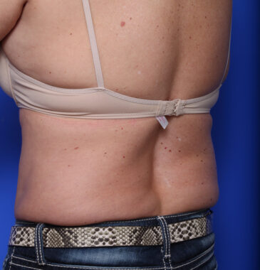 Case # 7 before photo