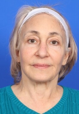 Case # 7 before photo