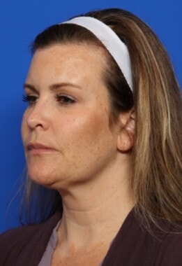 Case # 2 before photo