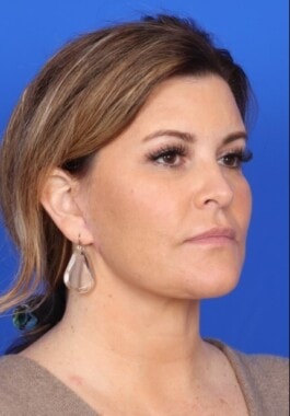 Case # 2 after photo