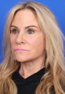 Case # 8 after photo