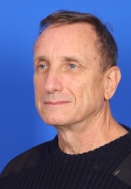 Case # 16 before photo