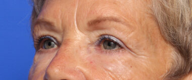 Case # 3 before photo