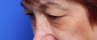 Case # 4 before photo