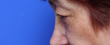 Case # 4 before photo