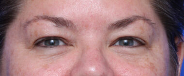 Case # 5 before photo