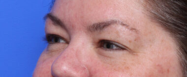 Case # 5 before photo