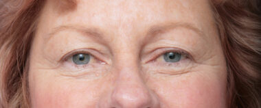 Case # 6 before photo