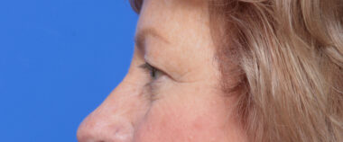 Case # 6 before photo