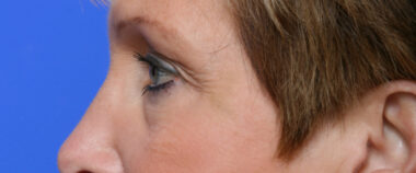 Case # 1 before photo