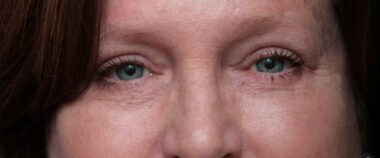 Case # 7 after photo