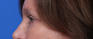 Case # 7 after photo