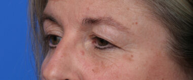 Case # 8 before photo