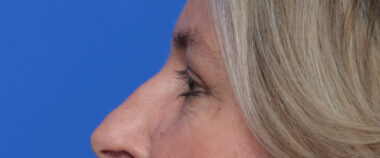 Case # 8 after photo