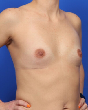 Case # 55 before photo