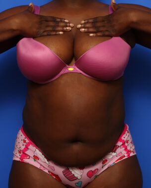 Case # 6 before photo