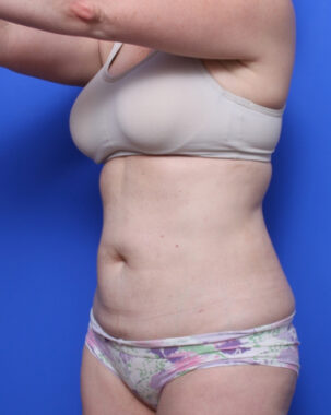 Case # 7 after photo