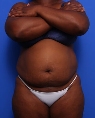 Case # 11 before photo