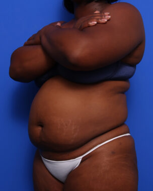 Case # 11 before photo