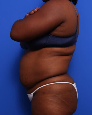 Case # 11 before photo