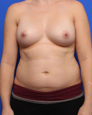 Case # 4 before photo