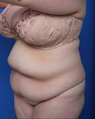 Case # 1 before photo