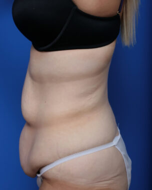 Case # 4 before photo