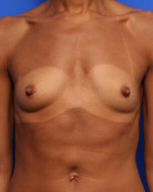 Case # 1 before photo