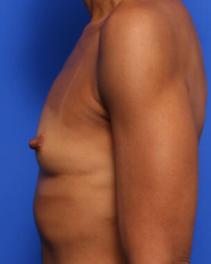 Case # 1 before photo