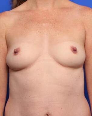 Case # 2 before photo