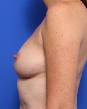 Case # 2 after photo