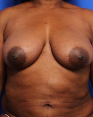 Case # 5 after photo