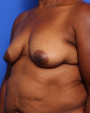 Case # 5 before photo