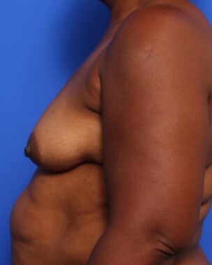 Case # 5 before photo