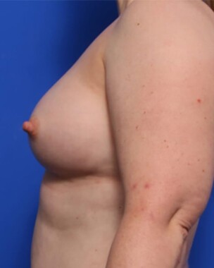 Case # 8 after photo