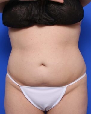 Case # 13 before photo