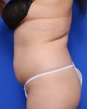 Case # 13 before photo